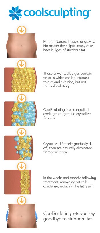 CoolSculpting - illustrative process