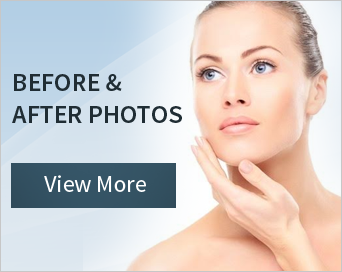 Before and After Photos | View More